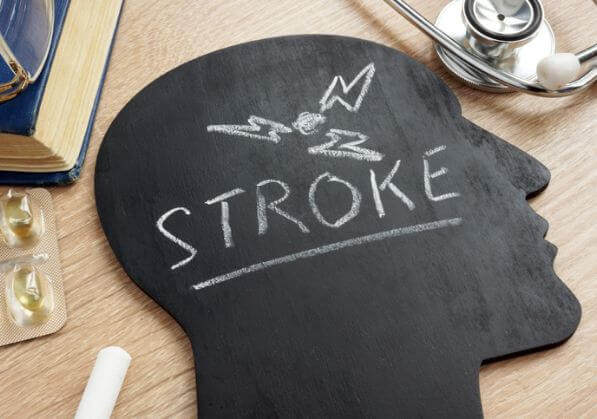 'Stroke' written on a blackboard in the shape of a human head